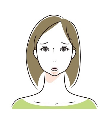 顎関節症：下顎後退症