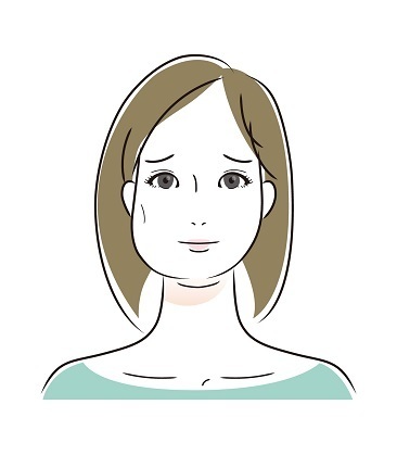 顎関節症：咬筋肥大